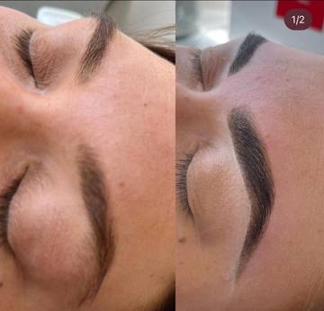 Eyebrow treatment 2