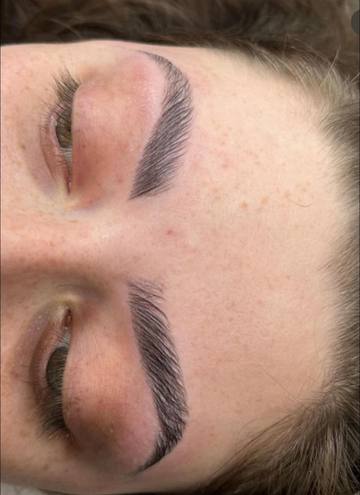 Eyebrow treatment 3